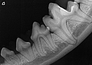 Dental X-ray VLR