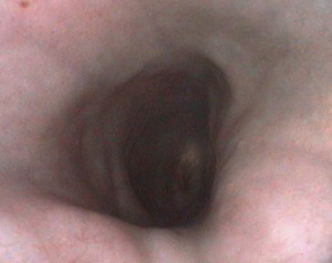 A view inside dog's esophagus 